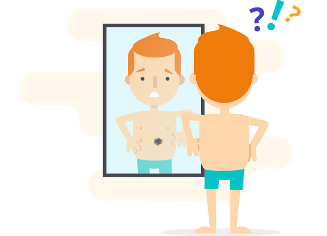 Nowe znamiona po opalaniu