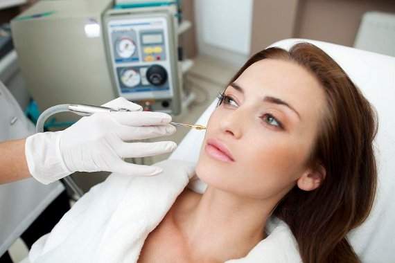 niechirurgiczne usuwanie znamion