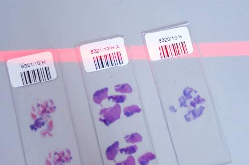 Szkiełka do rozmazu, które trafiają do laboratorium na badanie histopatologiczne