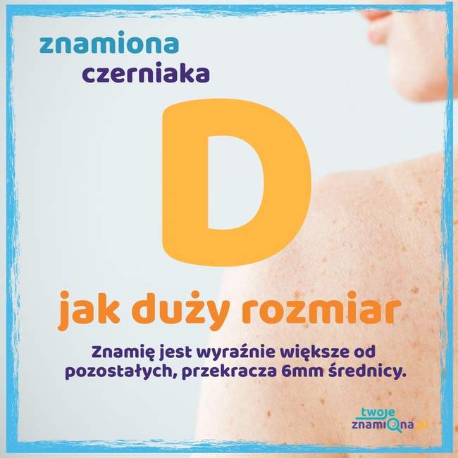 Duży rozmiar