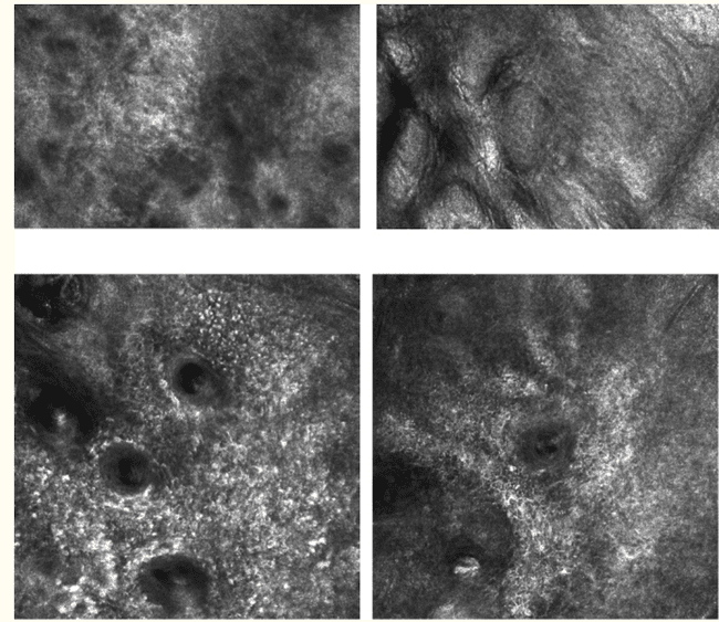 obraz mikroskopu konfokalnego