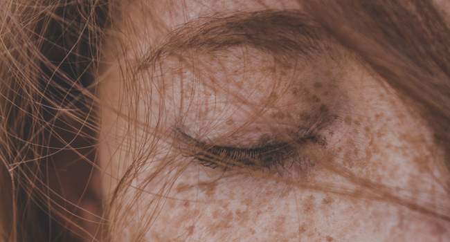 Jasna karnacja - zwiększa ryzyko pojawienia się objawów czerniaka.